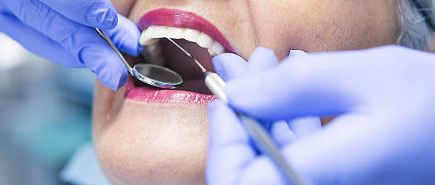 Best Emergency Dental Care for Broken or Chipped Teeth in Snyder, OK